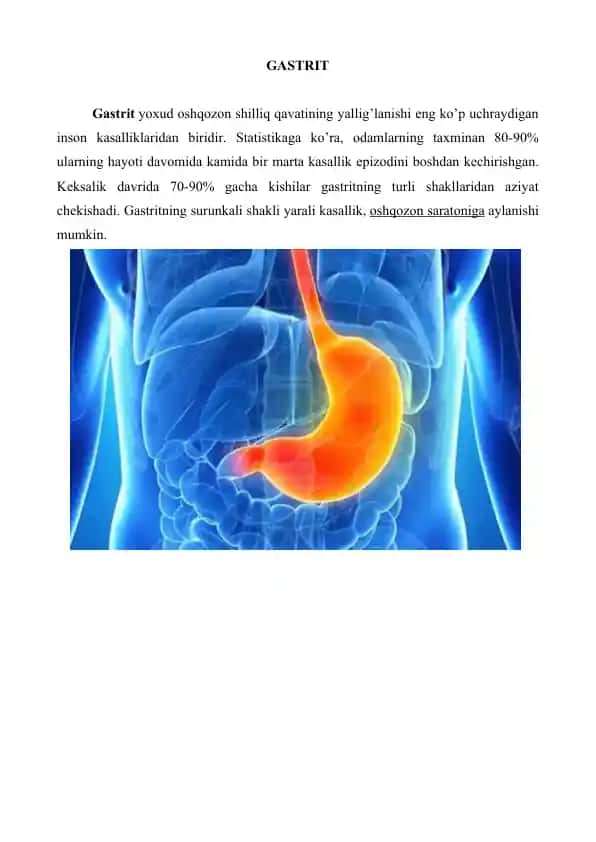 GASTRIT.