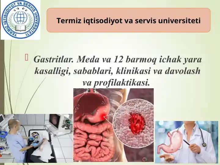 Gastritlar. Meda va 12 barmoq ichak yara kasalligi, sabablari, klinikasi va davolash va profilaktikasi