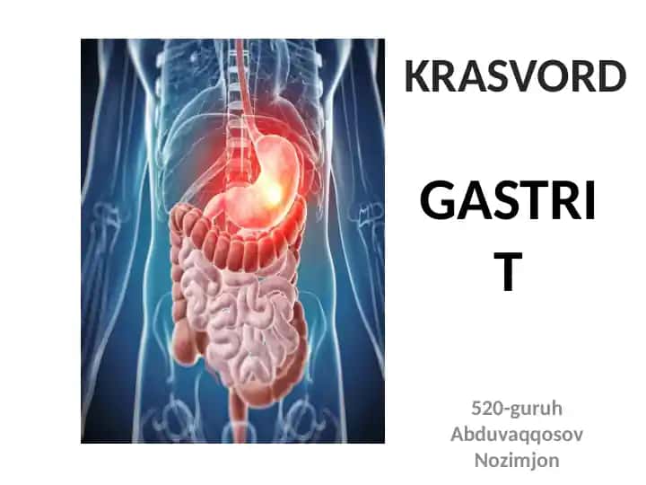 Gastrit