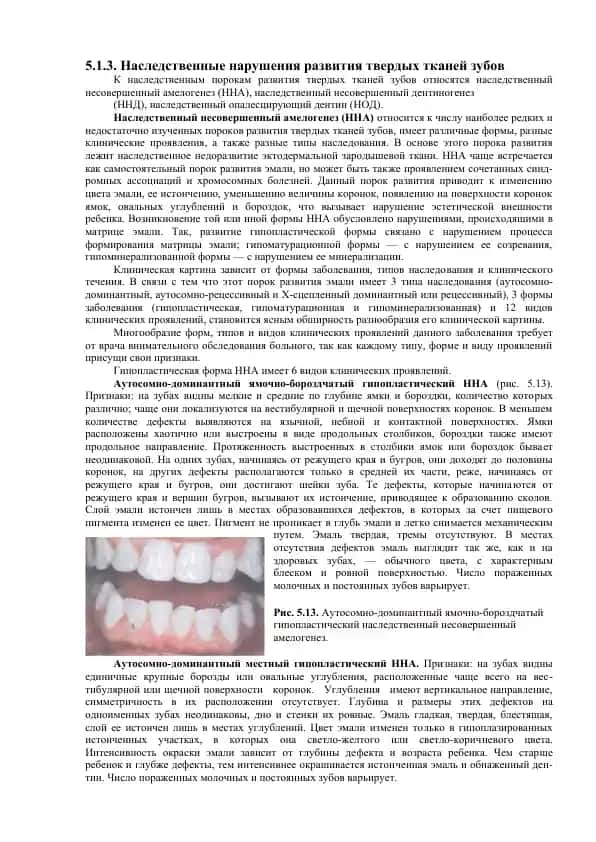 Наследственные нарушения развития твердых тканей зубов