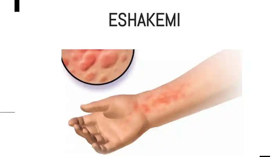Eshakemi