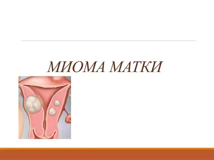 Mioma matki