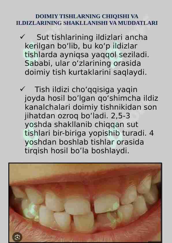 DOIMIY TISHLAR CHIQISH MUDDATLARI