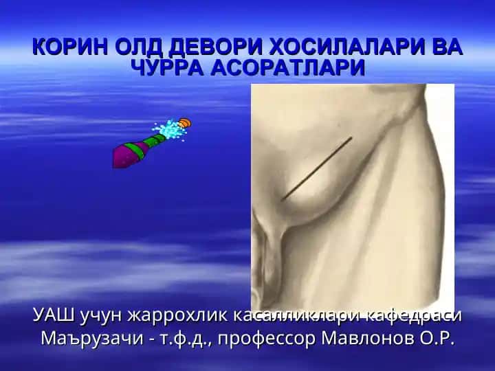 Korin old devori hosilalari va churra asoratlari