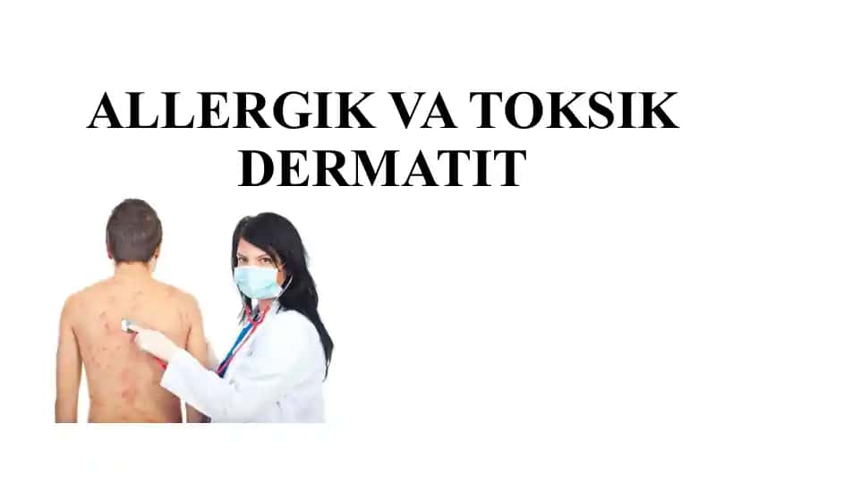ALLERGIKVA TOKSIKDERMATIT