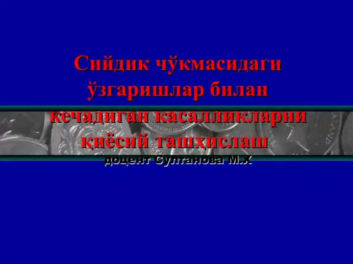 Сийдик чўкмасидаги ўзгаришлар билан кечадиган касалликларниқиёсийташҳислашдоцент Султанова М.Х