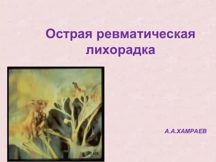Острая ревматическая лихорадка