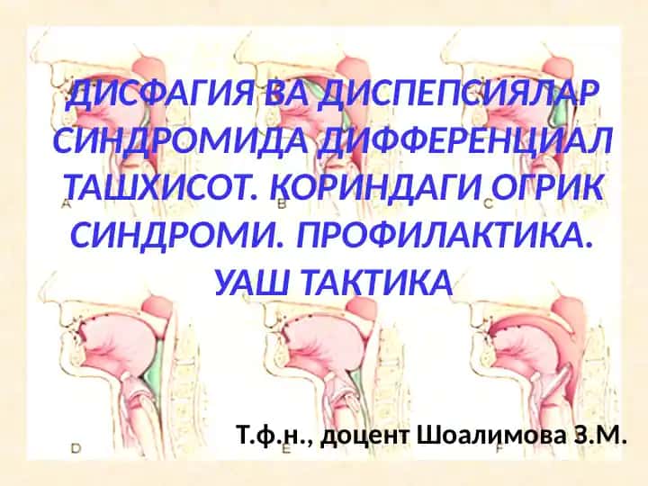 ДИСФАГИЯ ВА ДИСПЕПСИЯЛАР СИНДРОМИДА ДИФФЕРЕНЦИАЛ ТАШХИСОТ. КОРИНДАГИ ОГРИК СИНДРОМИ. ПРОФИЛАКТИКА. УАШ ТАКТИКА