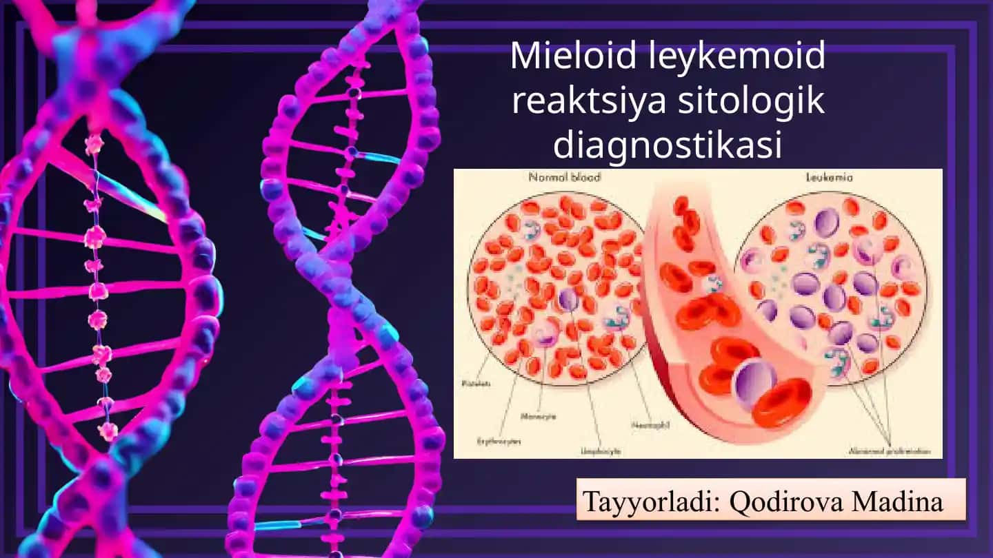Mieloid leykoidoid reaktsiya