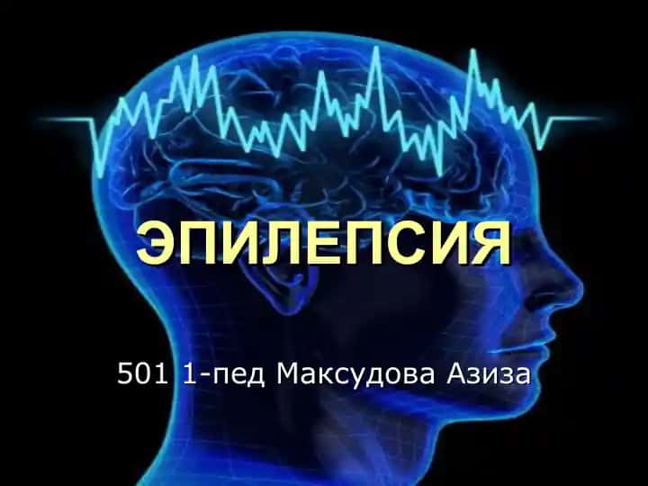 ЭПИЛЕПСИЯ