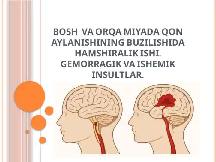 Bosh va Orqa Miyaning Qon Aylanishining Buzilishi