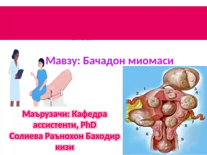 Бачадон миомаси
