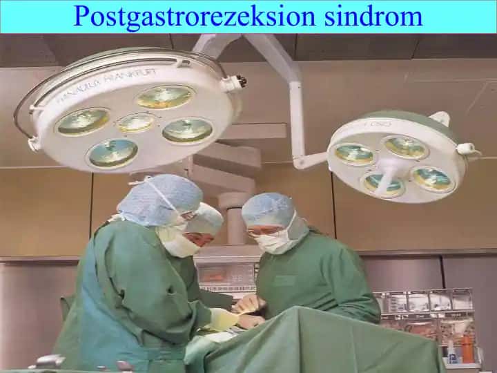 Postgastrorezeksion sindrom