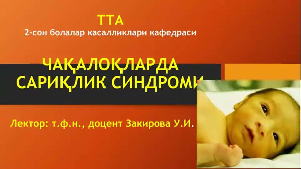 ЧАҚАЛОҚЛАРДА САРИҚЛИК СИНДРОМИ