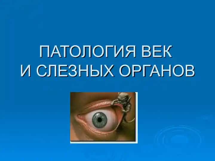 ПАТОЛОГИЯ ВЕК И СЛЕЗНЫХ ОРГАНОВ