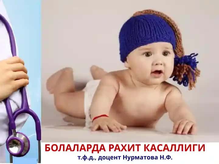 Болаларда рахит касаллиги