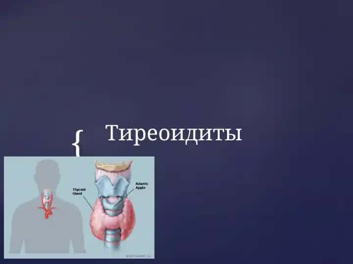 Тиреоидиты