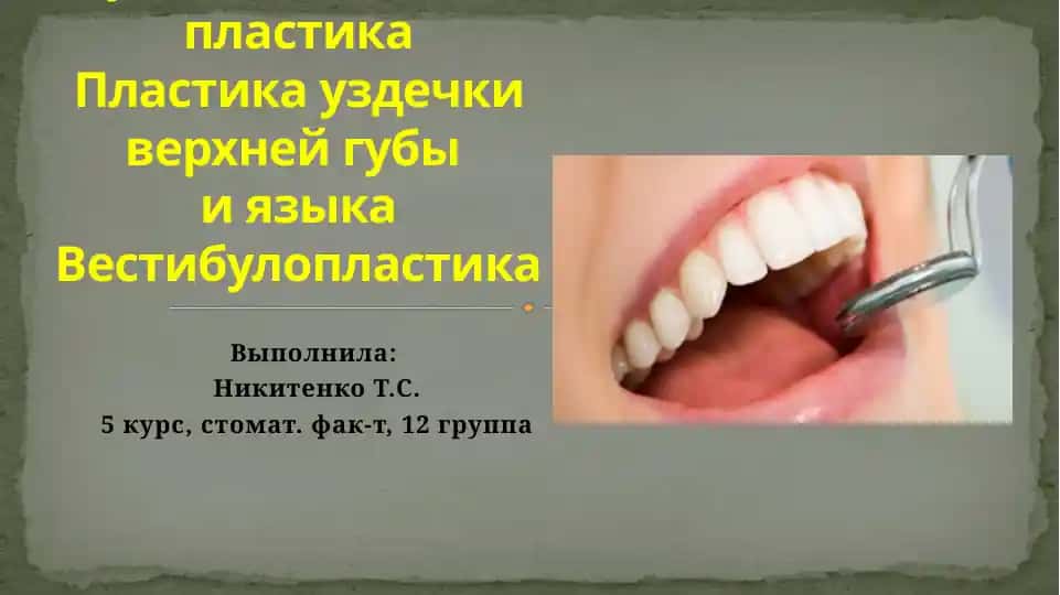 Мукогингивальная пластика