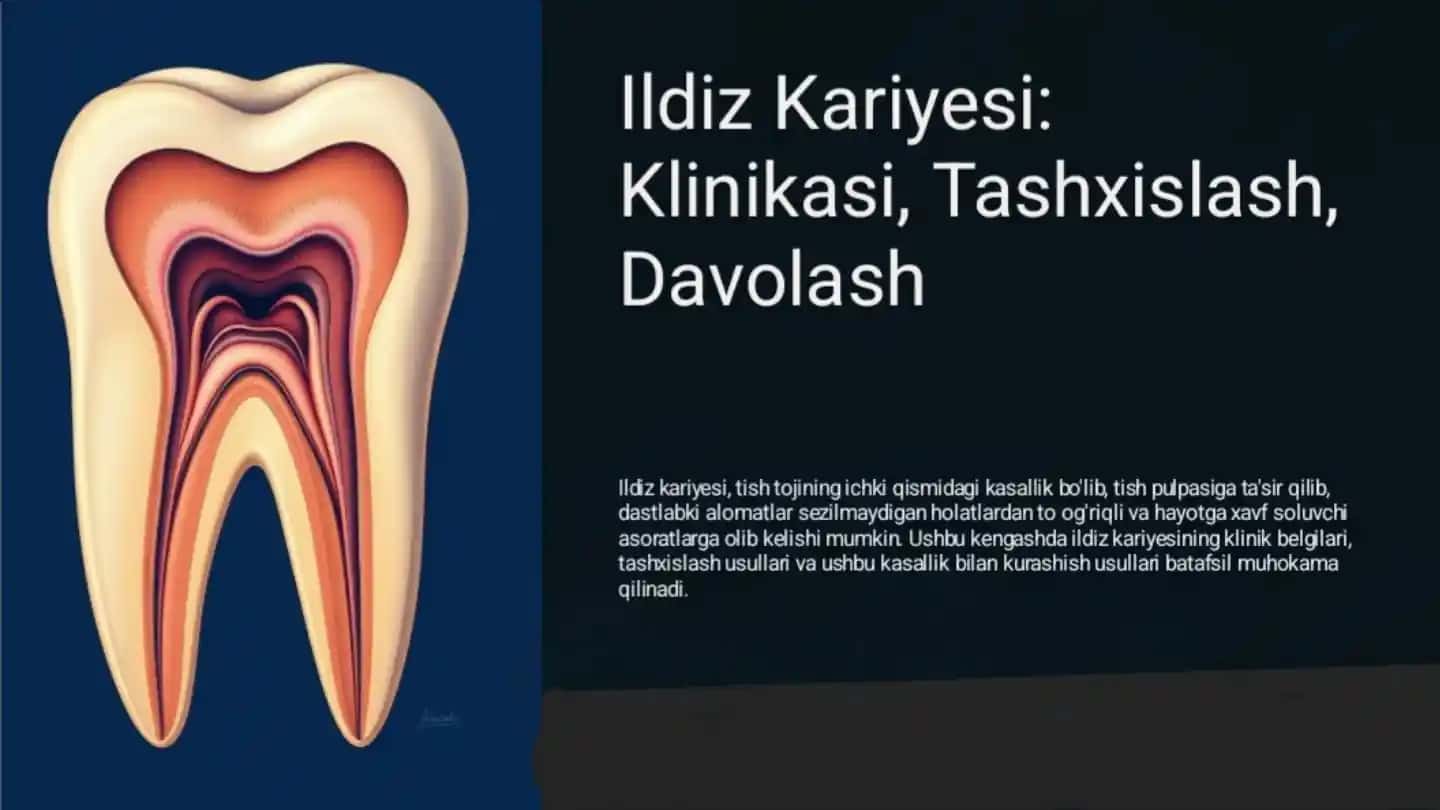 Ildiz kariesini tashxislash va davolash