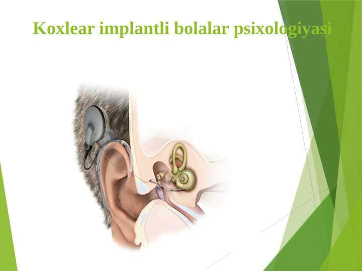 Koxlear implantli bolalar psixologiyasi