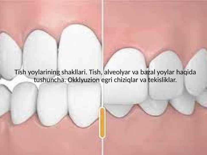 Tish yoylarining shakllari. Tish, alveolyar va bazal yoylar haqida tushuncha. Okklyuzion egri chiziqlar va tekisliklar
