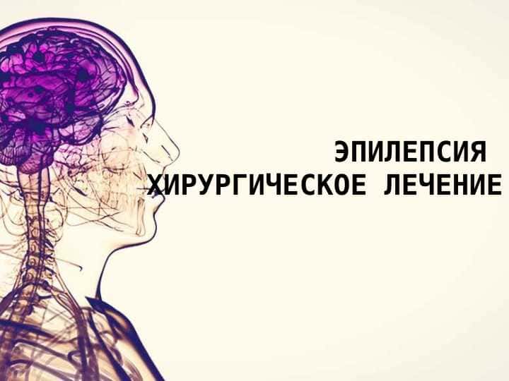 Эпилепсия хирургическое лечение