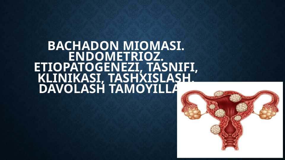 Bachadon miomasi. Endometrioz. Etiopatogenezi, tasnifi, klinikasi, tashxislash, davolash tamoyillari