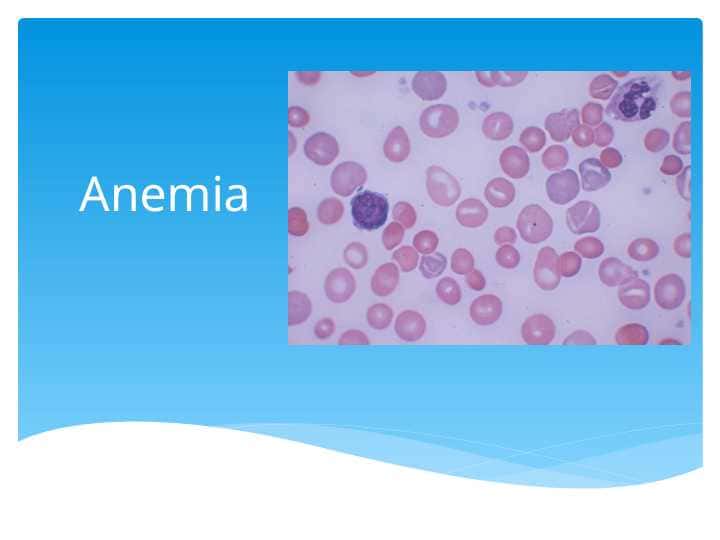 Anemia Anemia is a laboratory diagnosis