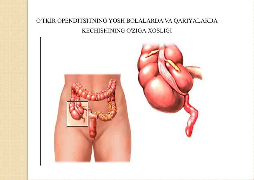 O'TKIR OPENDITSITNING YOSH BOLALARDA VA QARIYALARDA KECHISHINING O'ZIGA XOSLIGI