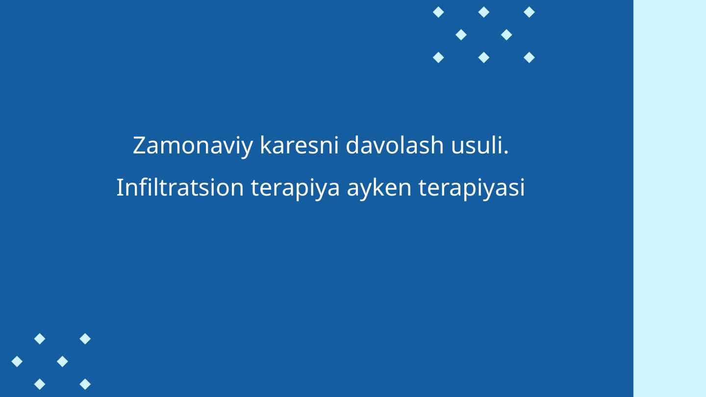 Zamonaviy karesni davolash usuli. Infiltratsion terapiya ayken terapiyasi t.pptx