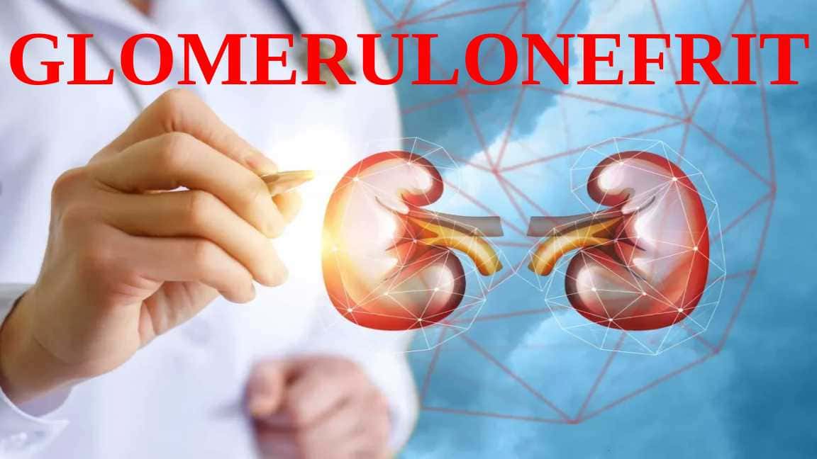GLOMERULONEFRIT