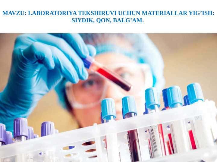 LABORATORIYA TEKSHIRUVI UCHUN MATERIALLAR YIG’ISH: SIYDIK, QON, BALG’AM.