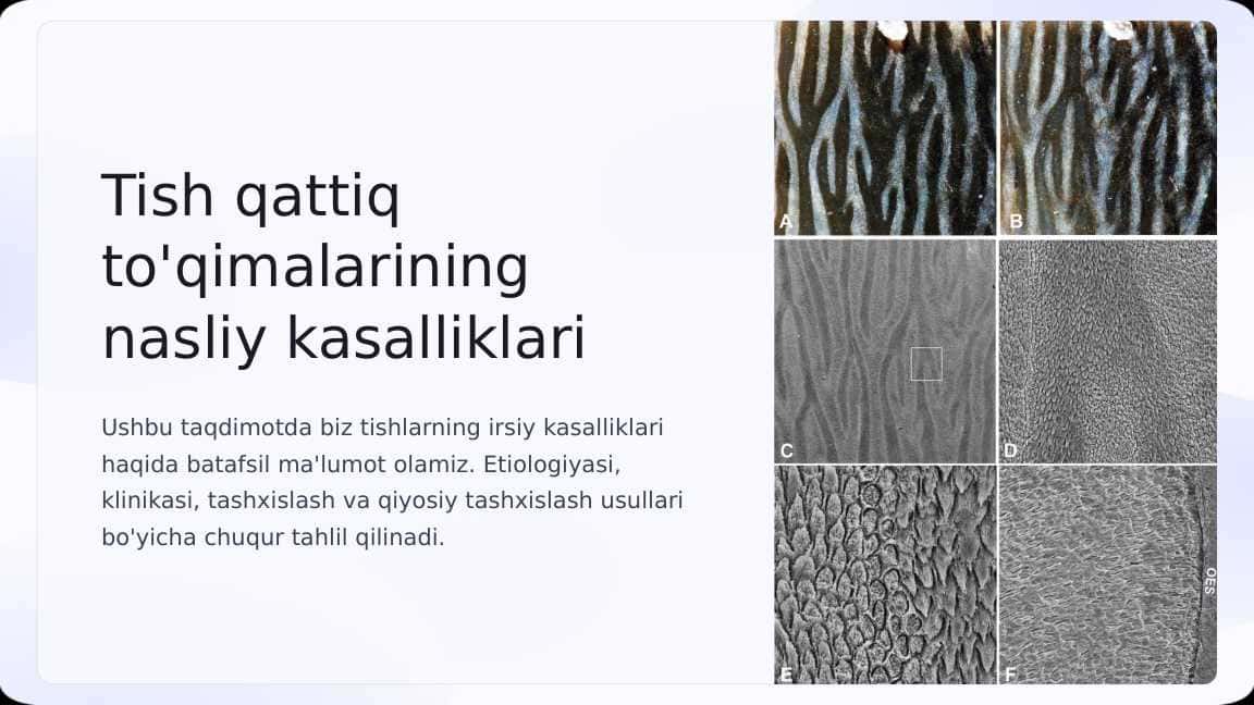 Tish qattiq to‘qimalarining nasliy kasalliklari. Etiologiyasi, klinikasi, tashxislash va qiyosiy tashxislash.