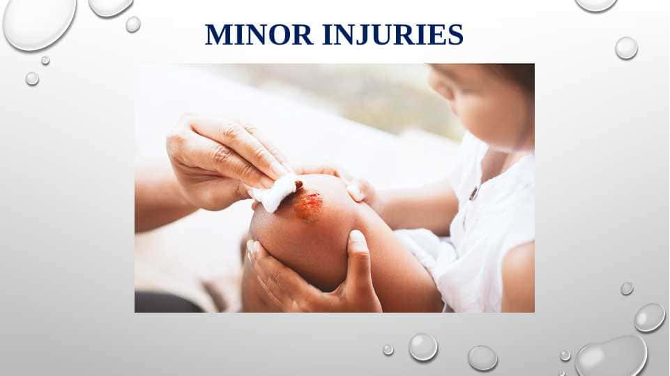 Minor Injuries