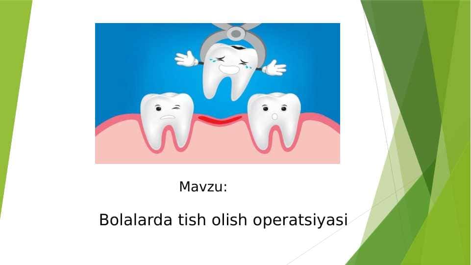 Bolalarda tish olish operatsiyasi