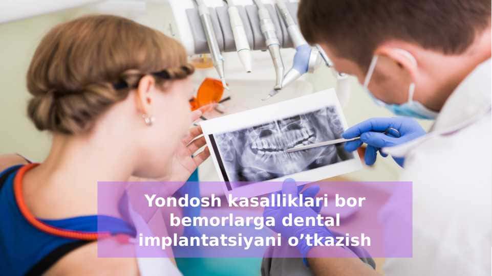 Yondosh kasalliklari bor bemorlarga dental implantatsiyani oʼtkazish