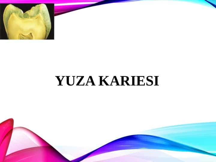 Yuza karies