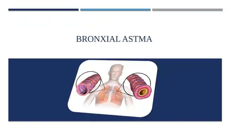BRONXIAL ASTMA
