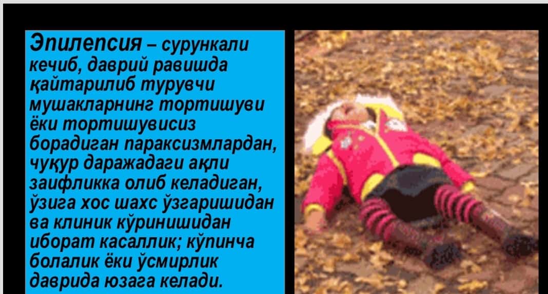 Nevrologiya . Epilepsiya kasalligi . Эпилепсия касаллиги