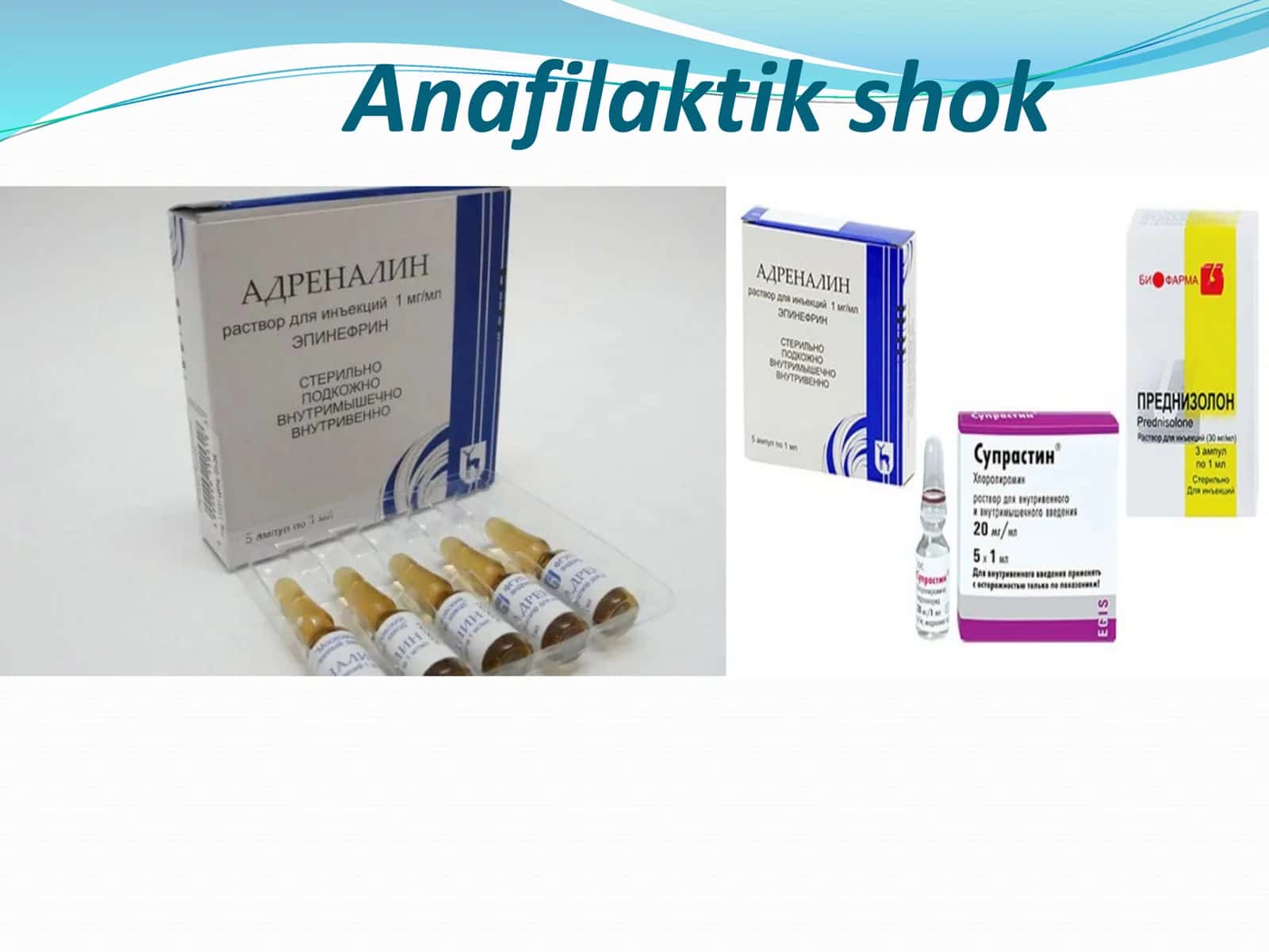 Anafilaktik shok
