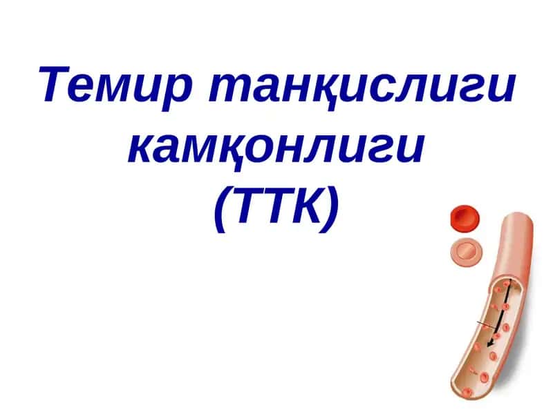 Temir tanqisligi kamqonligi | Темир танқислиги камқонлиги(ТТК)