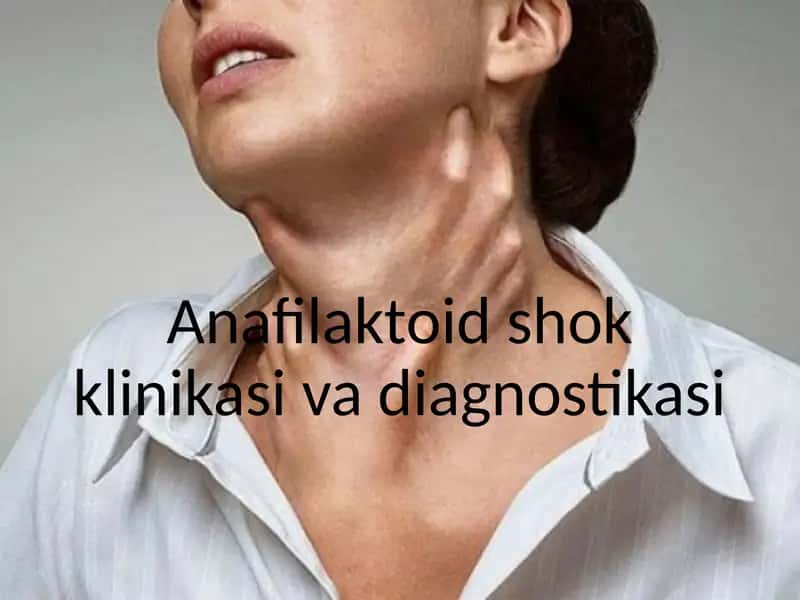 Anafilaktoid shok klinikasi va diagnostikasi