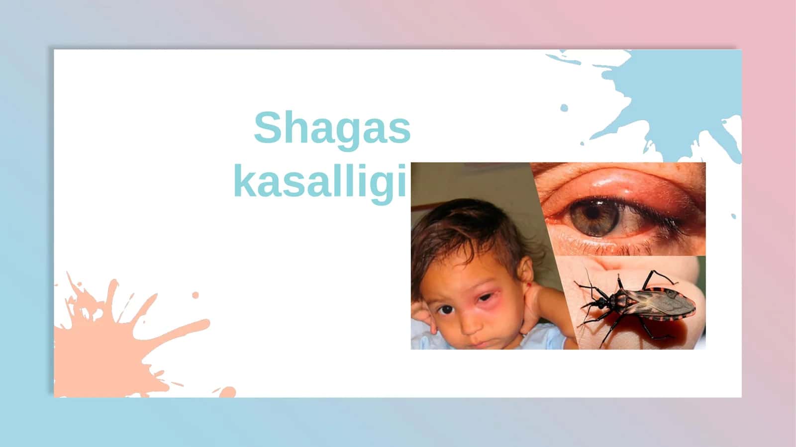 Chagas kasalligi - Trypanosoma cruzi (T. cruzi) parazitidan kelib chiqqan yuqumli kasallik