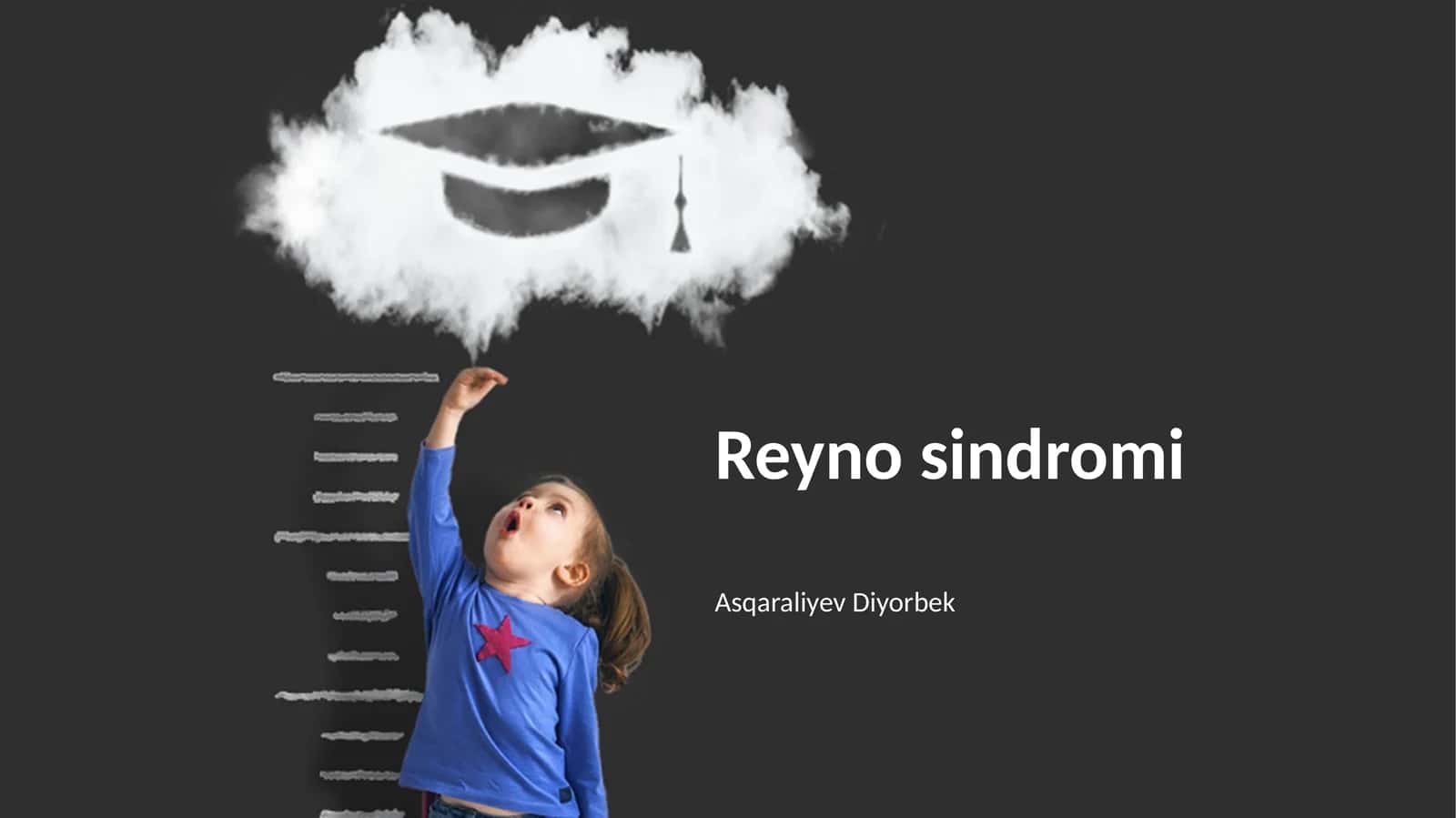 Raynaud Sindromi