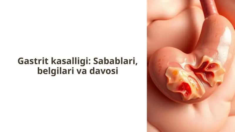 Gastrit kasalligi: Sabablari, belgilari va davosi
