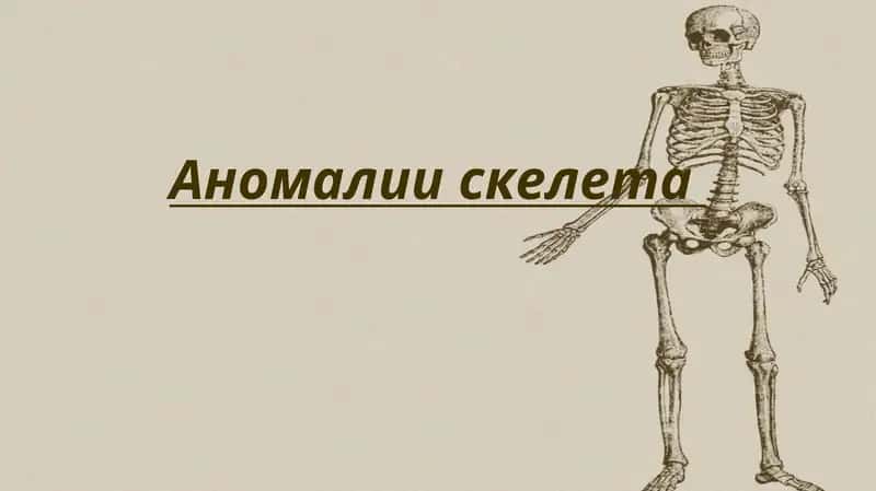Аномалии скелета
