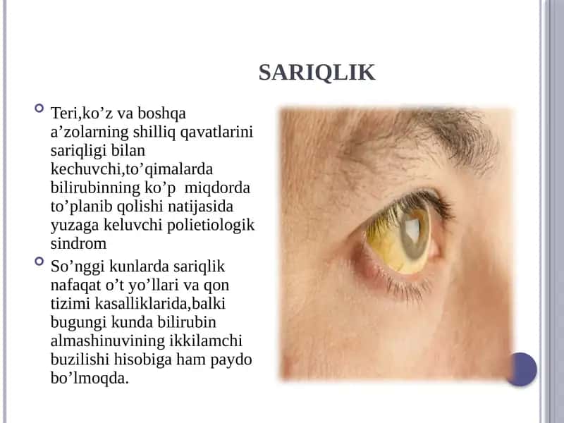 SARIQLIK