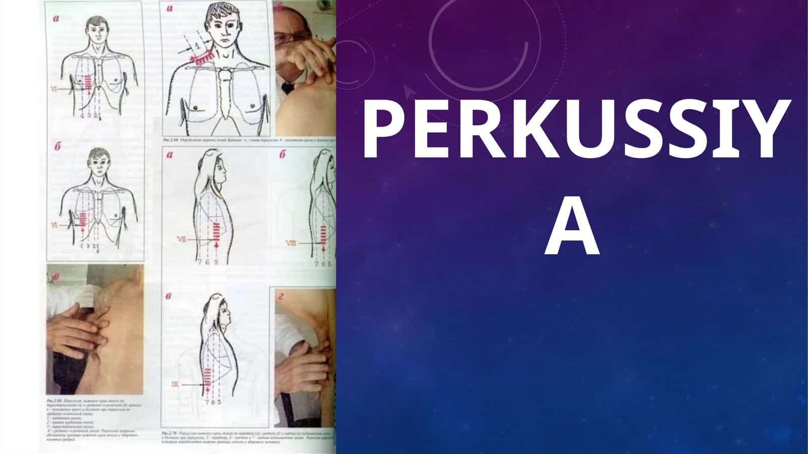 Perkussiya